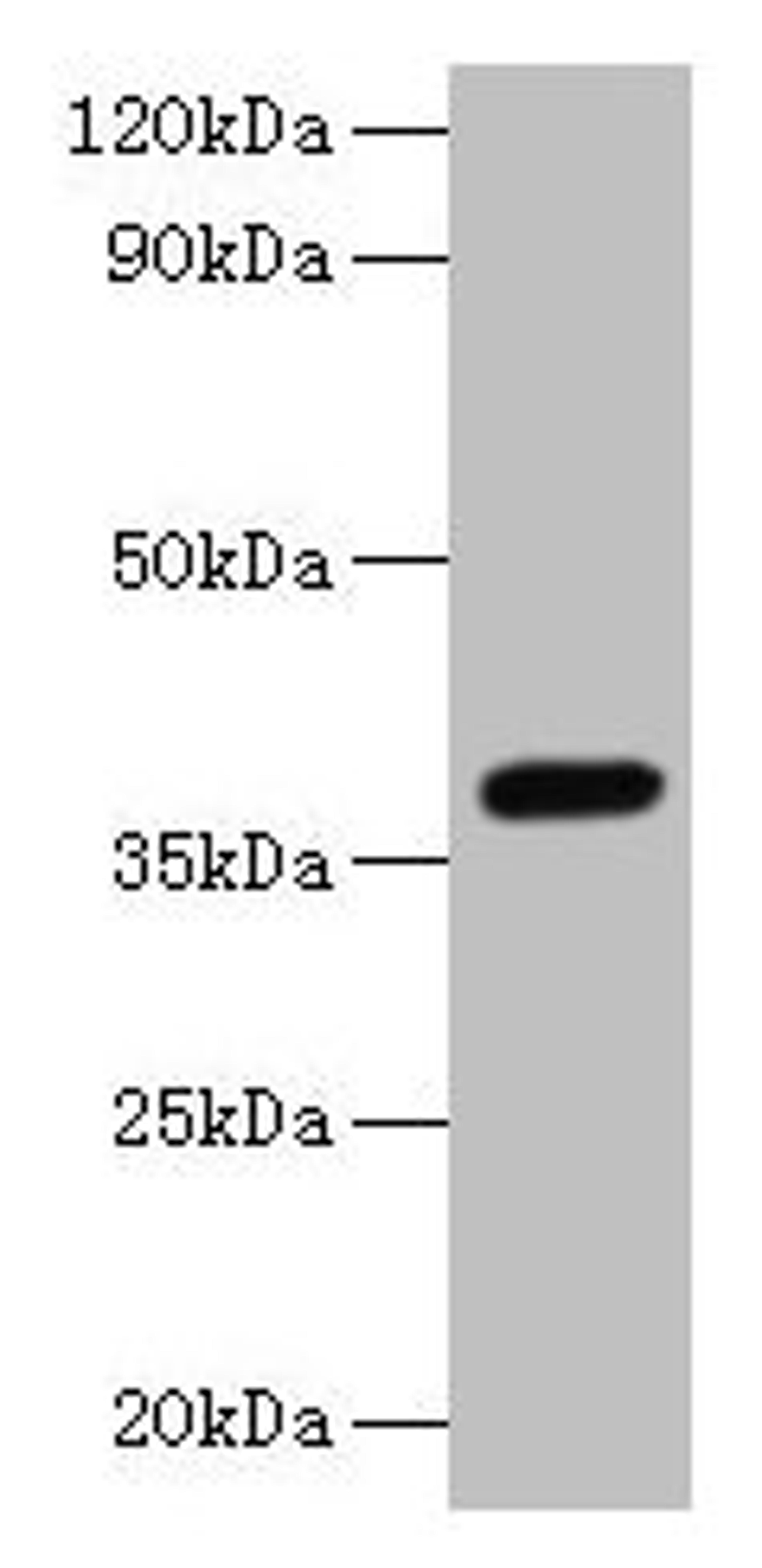 Western blot. All lanes: LRG1 antibody at 2µg/ml + Mouse liver tissue. Secondary. Goat polyclonal to rabbit IgG at 1/10000 dilution. Predicted band size: 39 kDa. Observed band size: 39 kDa