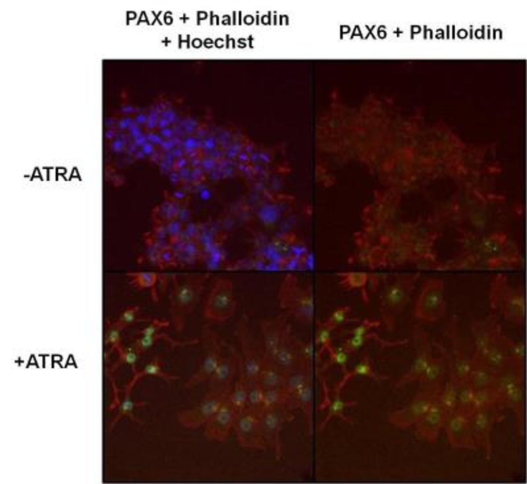 Immunocytochemistry/Immunofluorescence: Pax6 Antibody [NB300-750] - Formalin fixed cells were permeabilized with 0.1% Triton X-100 in TBS for 10 minutes at room temperature and blocked with 1% Blocker BSA for 15 minutes at room temperature. Cells were probed with a PAX6 polyclonal antibody at a dilution of 1:400 for 30 minutes at room temperature. F-Actin (red) was stained with DyLight 554 Phalloidin were stained with Hoechst 33342 dye.