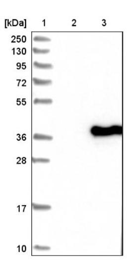 Western Blot: SFXN2 Antibody [NBP1-85960] - Lane 1: Marker [kDa] 250, 130, 95, 72, 55, 36, 28, 17, 10<br/>Lane 2: Negative control (vector only transfected HEK293T lysate)<br/>Lane 3: Over-expression lysate (Co-expressed with a C-terminal myc-DDK tag (~3.1 kDa) in mammalian HEK293T cells, LY403612)