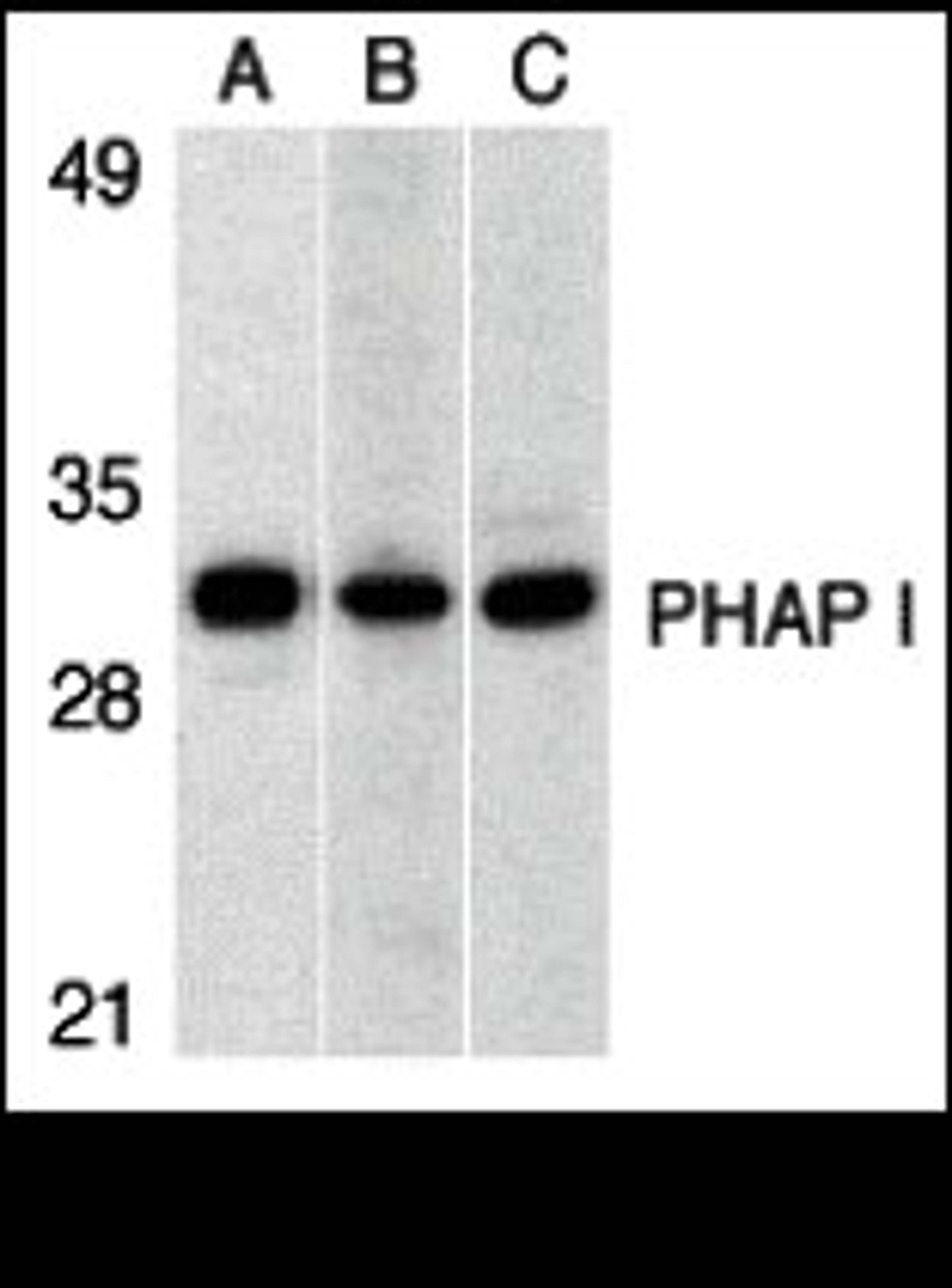 Western blot analysis of PHAP I expression in human Raji cell (A), mouse (B) and rat (C) testis tissue llysates with PHAP I antibody at 1 &#956;g/mL. 