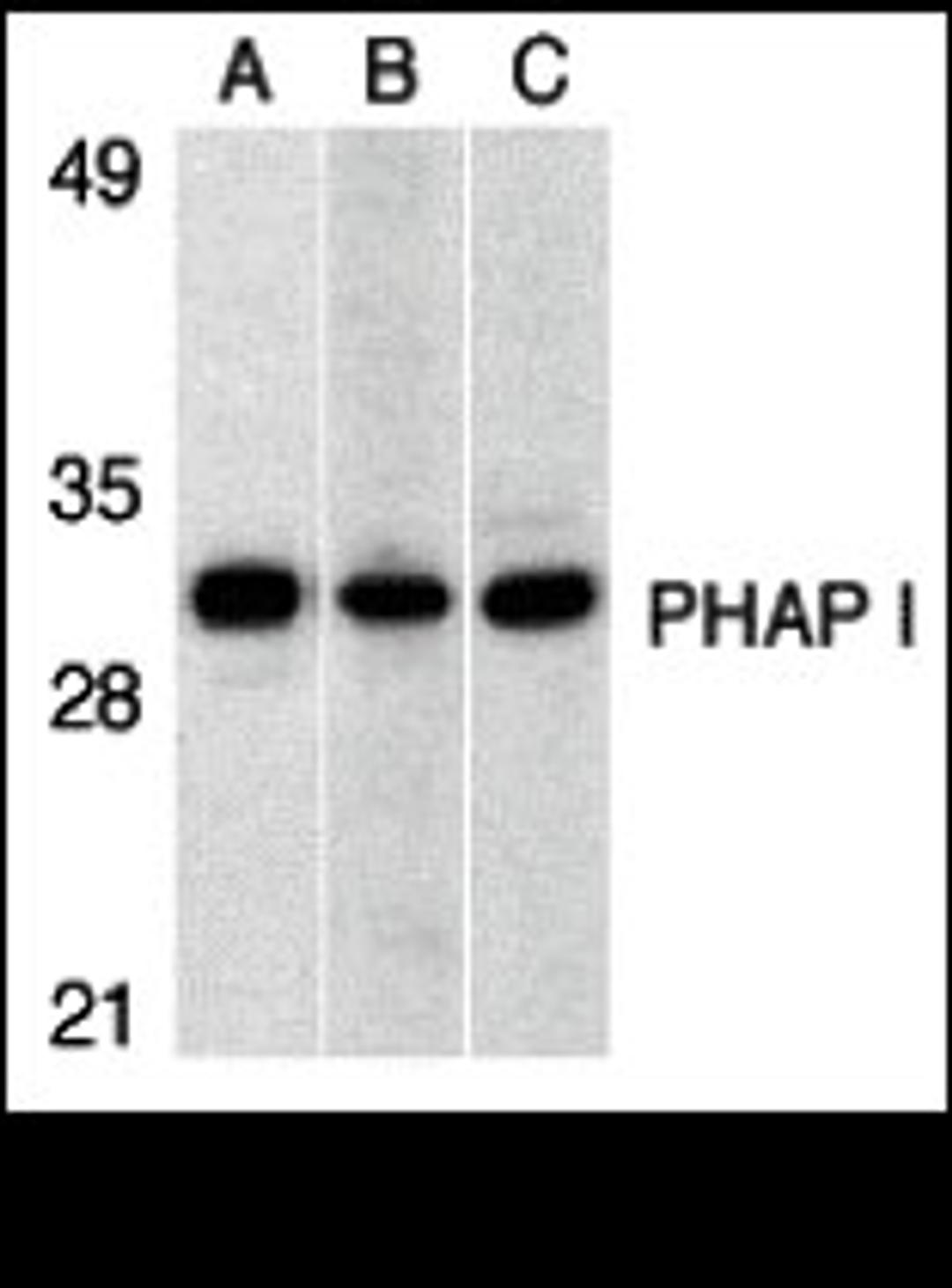Western blot analysis of PHAP I expression in human Raji cell (A), mouse (B) and rat (C) testis tissue llysates with PHAP I antibody at 1 μg/mL.