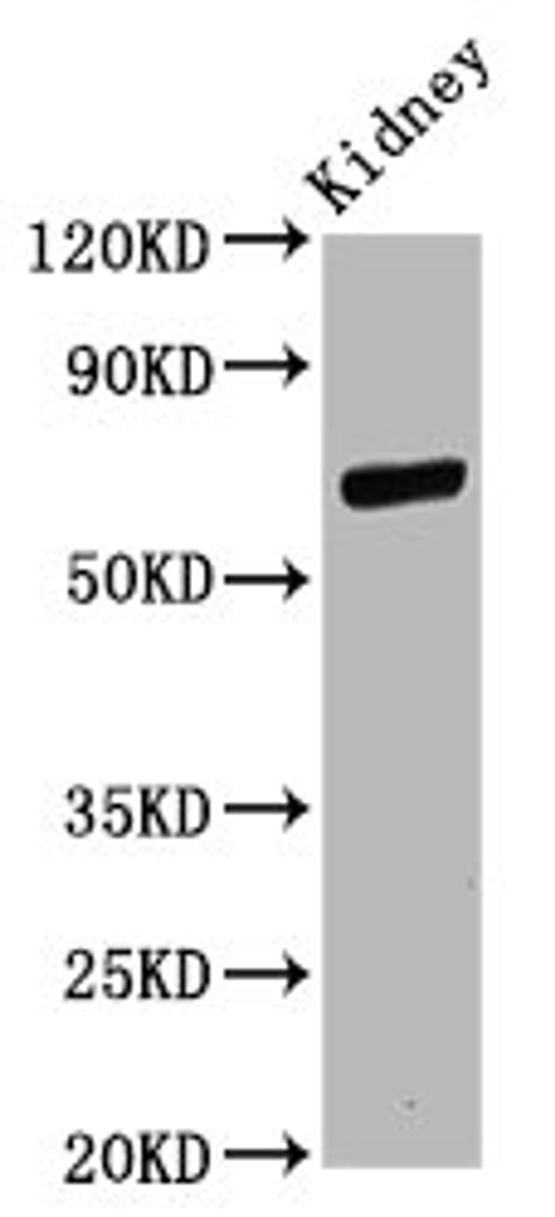 Western Blot. Positive WB detected in: Rat kidney tissue. All lanes: CD2AP antibody at 11ug/ml. Secondary. Goat polyclonal to rabbit IgG at 1/50000 dilution. Predicted band size: 72 kDa. Observed band size: 72 kDa. 