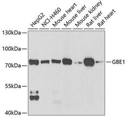 Western blot - GBE1 antibody (A6599)