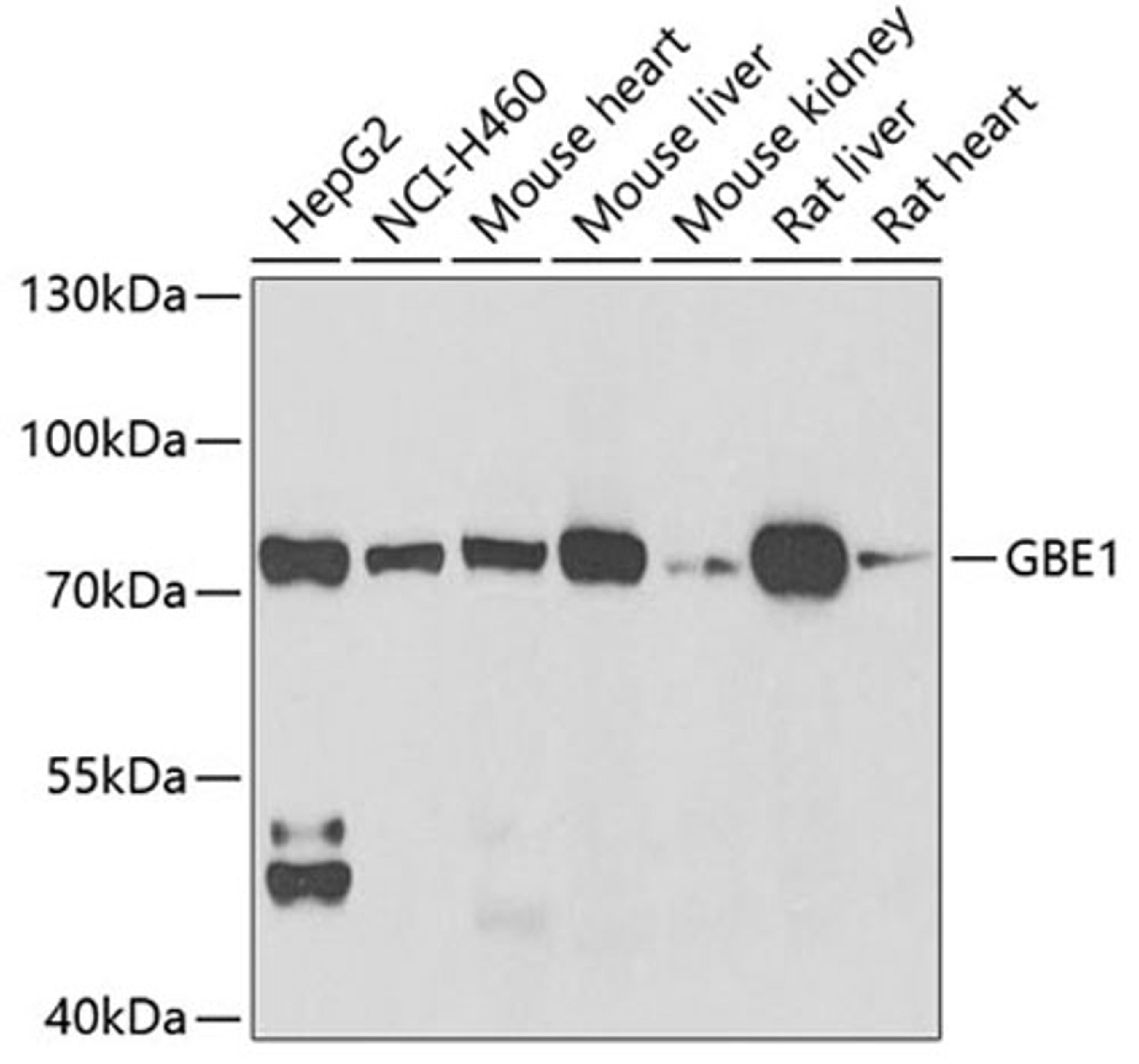 Western blot - GBE1 antibody (A6599)