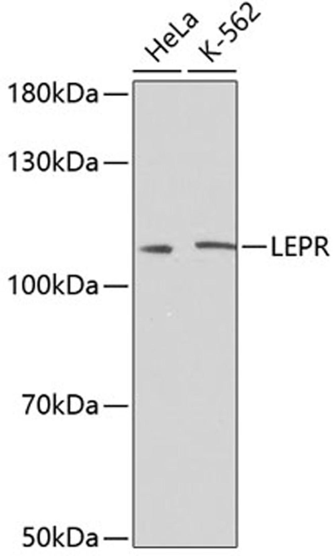 Western blot - LEPR antibody (A2999)