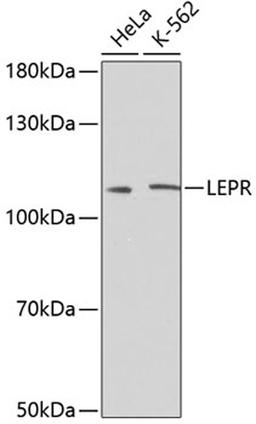 Western blot - LEPR antibody (A2999)