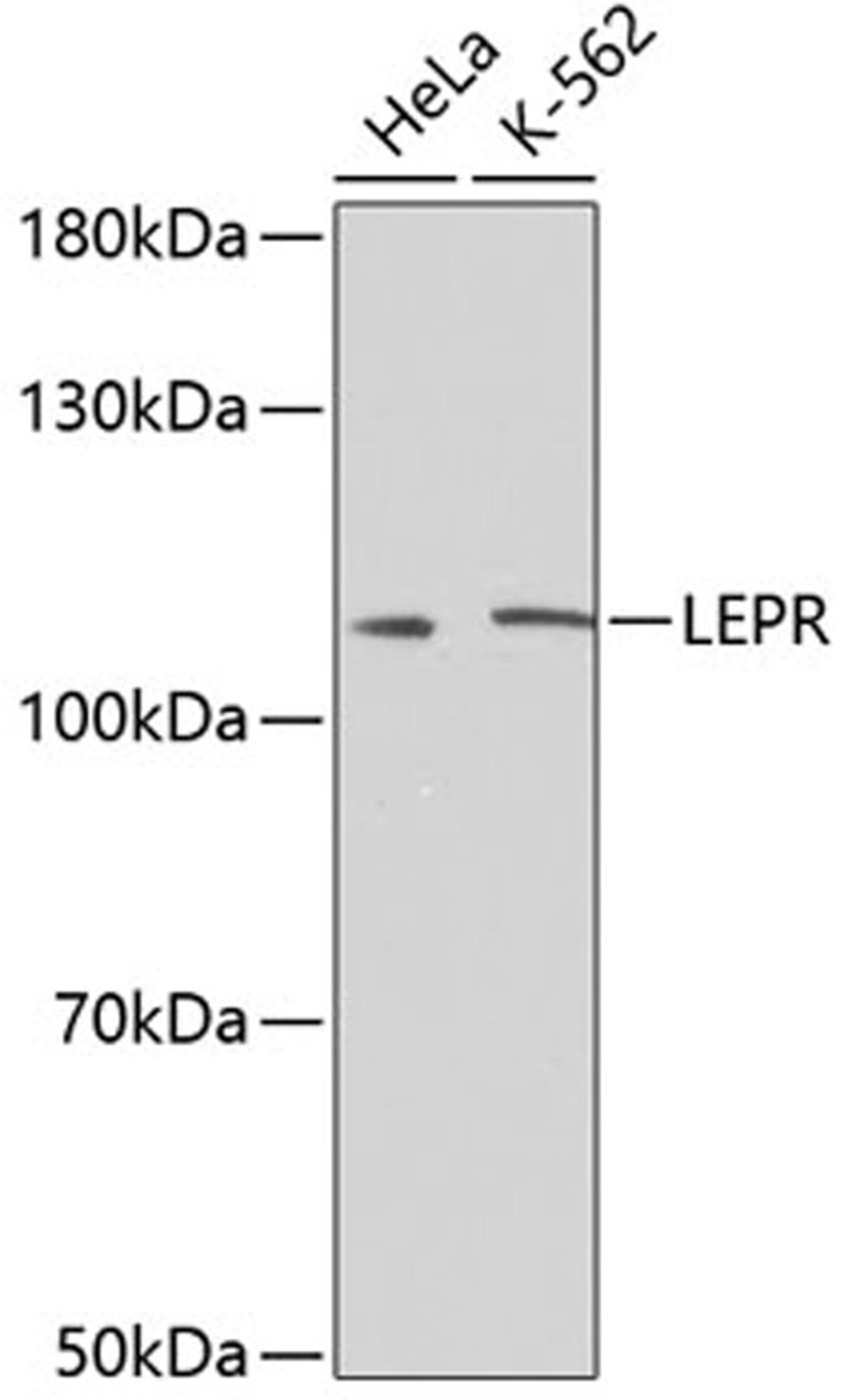 Western blot - LEPR antibody (A2999)