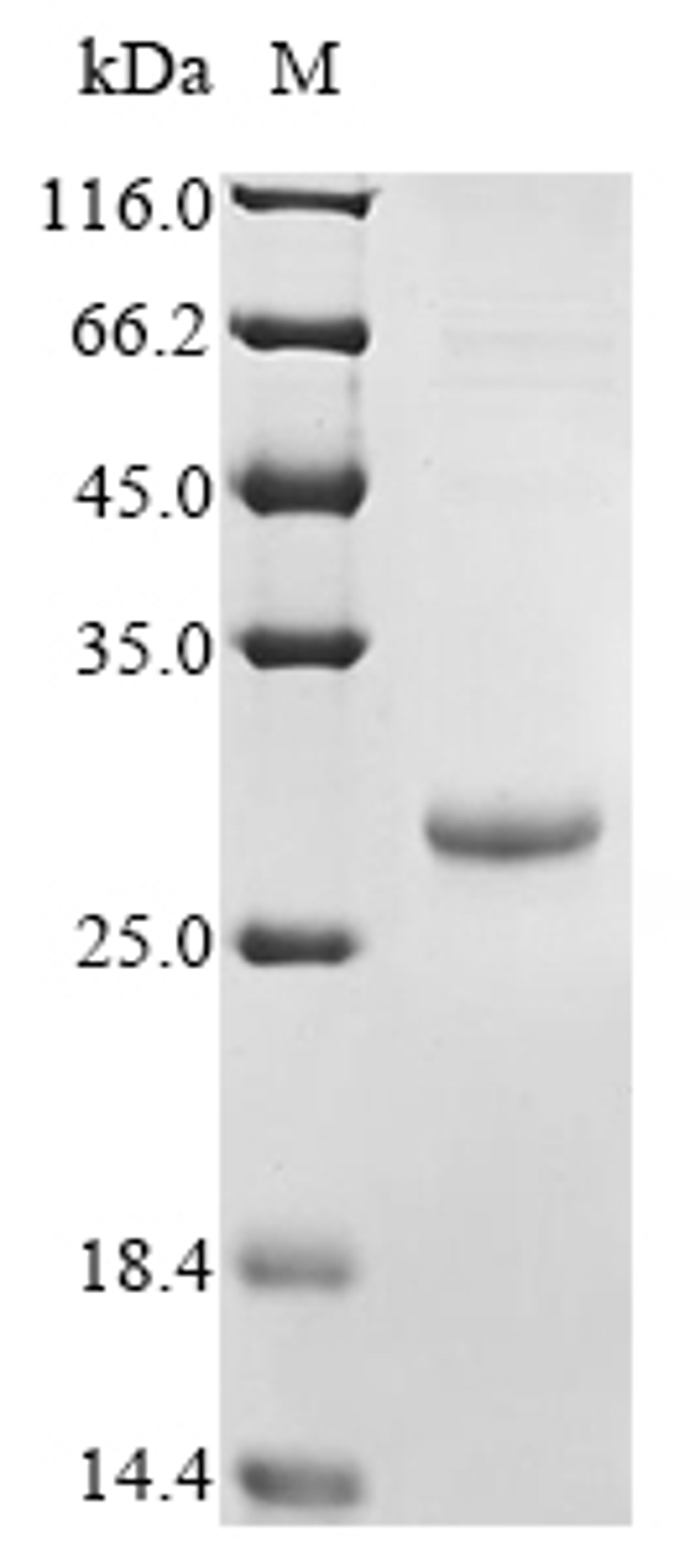 (Tris-Glycine gel) Discontinuous SDS-PAGE (reduced) with 5% enrichment gel and 15% separation gel.
