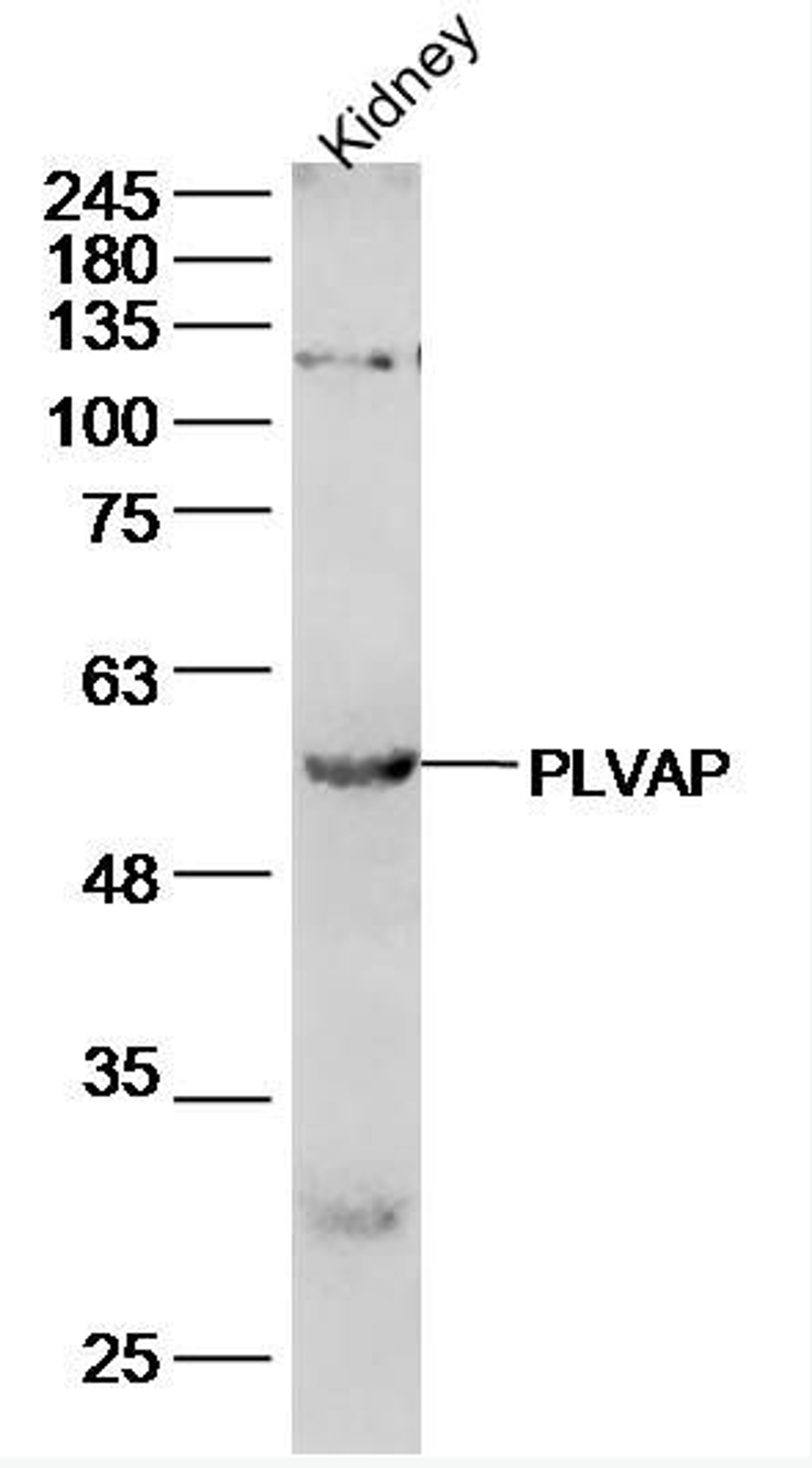 Western blot analysis of mouse kidney lysate using PLVAP antibody