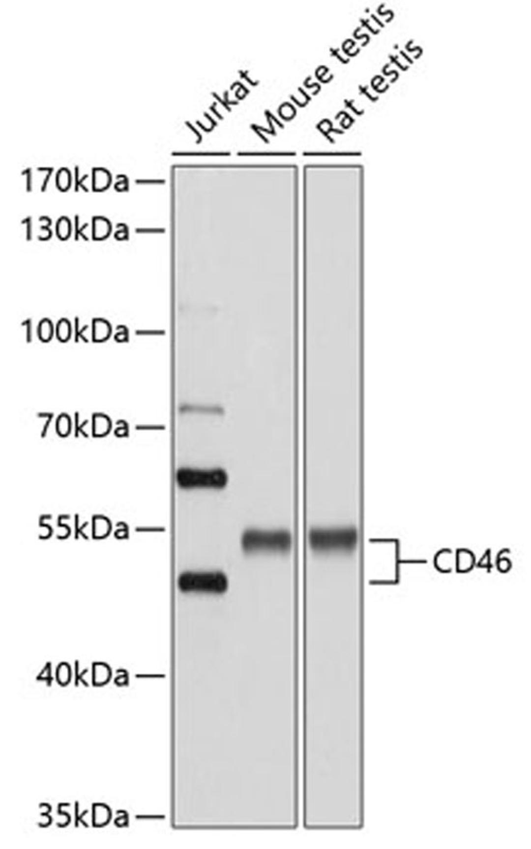 Western blot - CD46 antibody (A1653)