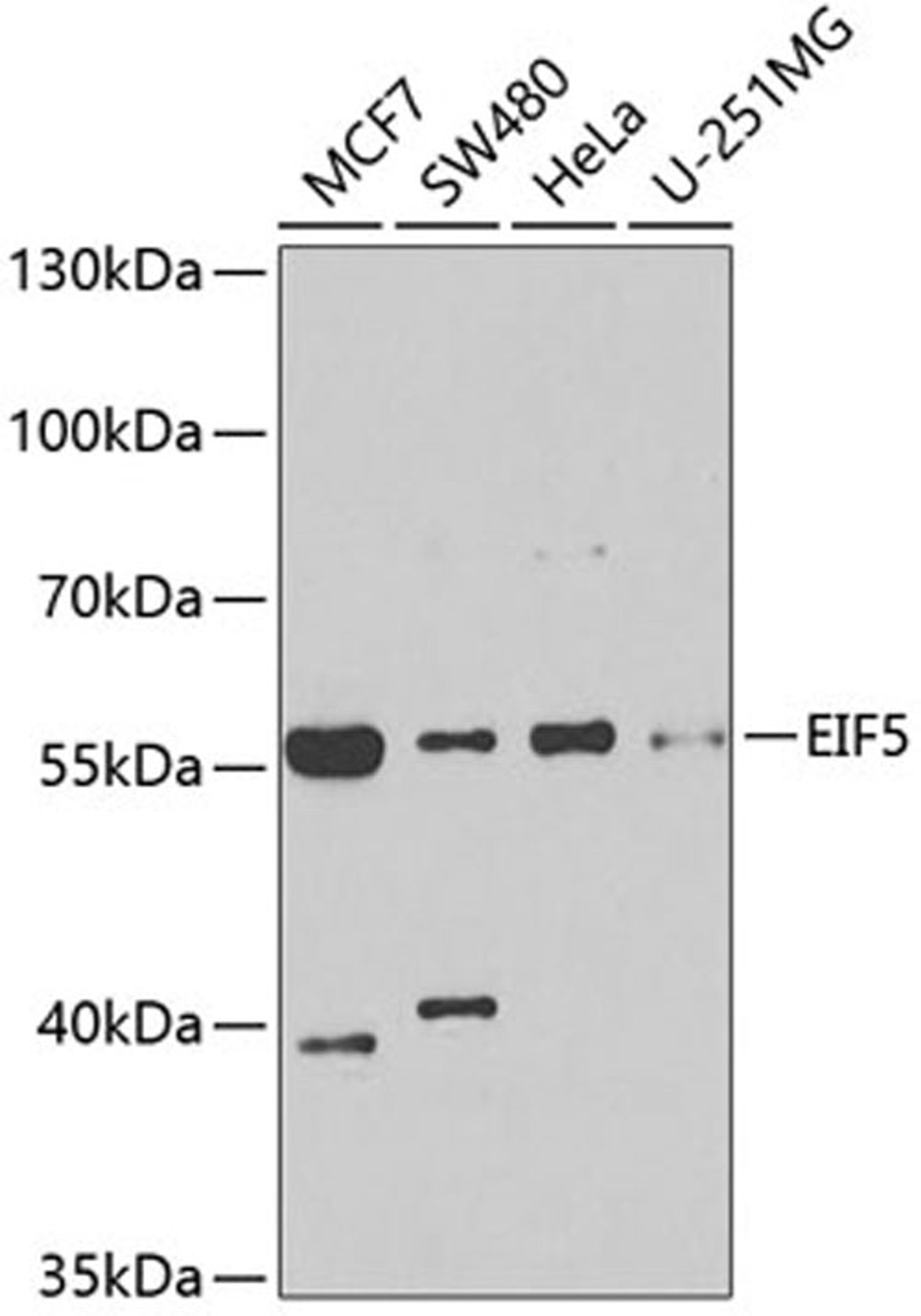 Western blot - EIF5 antibody (A6583)