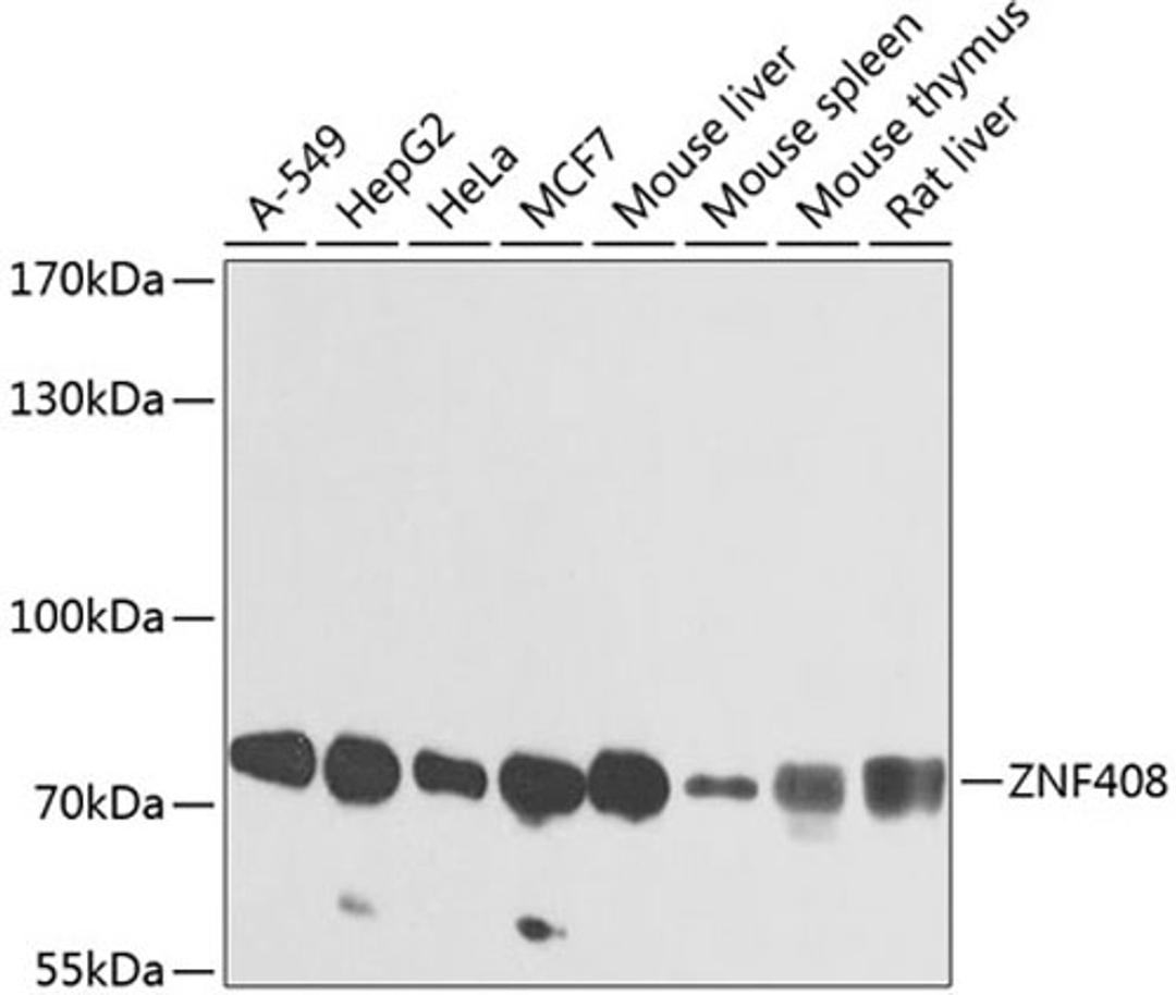 Western blot - ZNF408 antibody (A8512)