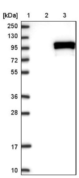 Western Blot: CHSS2 Antibody [NBP1-88087] - Lane 1: Marker [kDa] 250, 130, 95, 72, 55, 36, 28, 17, 10<br/>Lane 2: Negative control (vector only transfected HEK293T lysate)<br/>Lane 3: Over-expression lysate (Co-expressed with a C-terminal myc-DDK tag (~3.1 kDa) in mammalian HEK293T cells, LY403000)