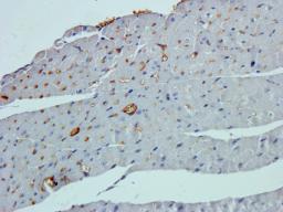 Immunohistochemical staining of paraffin embedded mouse heart tissue using beta 1 Adrenergic Receptor  antibody (primary antibody at 2.5 ug/ml)