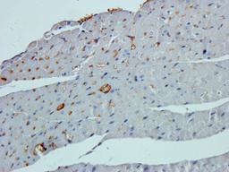 Immunohistochemical staining of paraffin embedded mouse heart tissue using beta 1 Adrenergic Receptor antibody (primary antibody at 2.5 ug/ml)