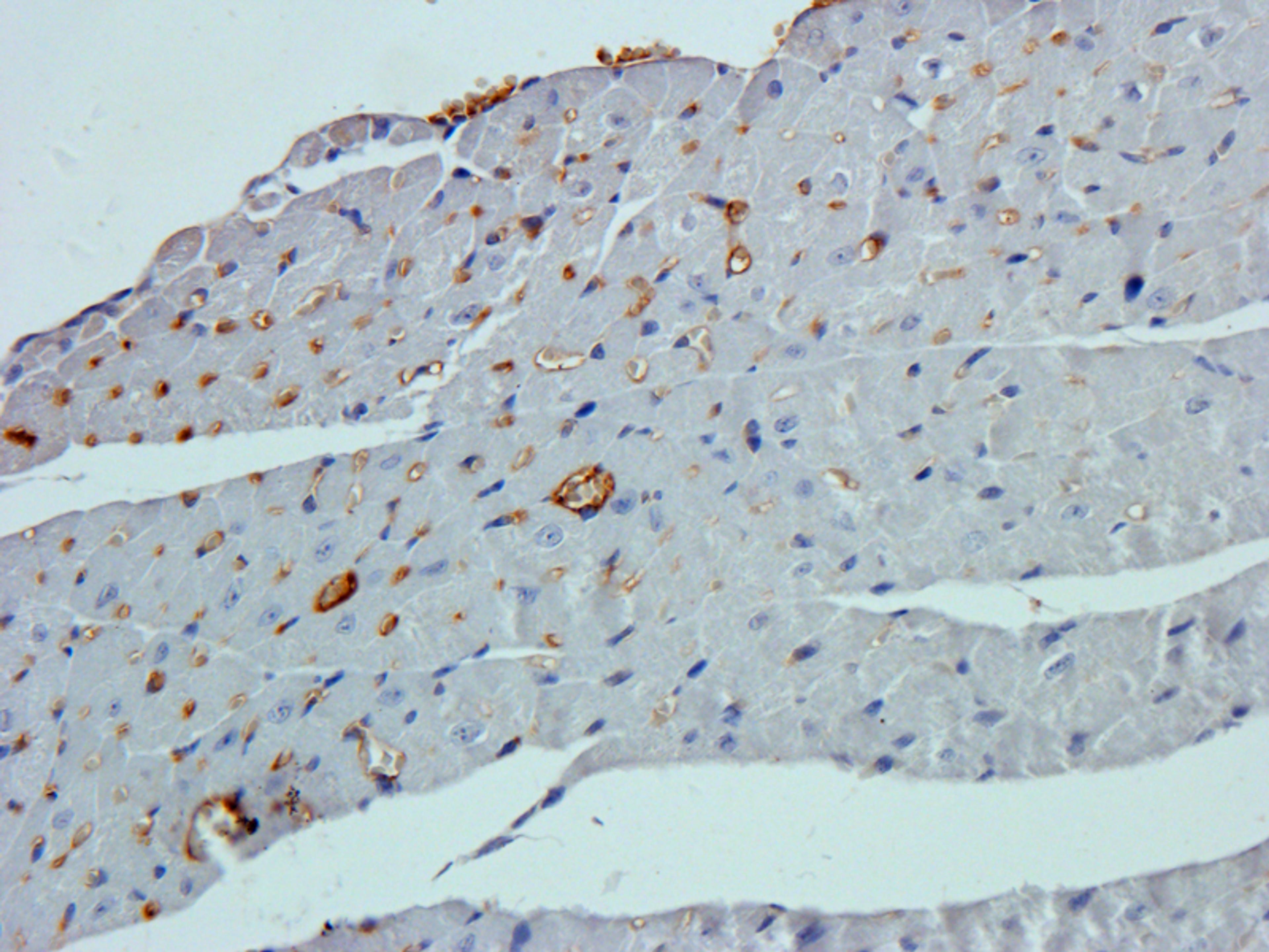 Immunohistochemical staining of paraffin embedded mouse heart tissue using beta 1 Adrenergic Receptor antibody (primary antibody at 2.5 ug/ml)