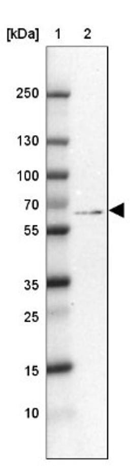 Western Blot: PARP2 Antibody [NBP2-47337] - Lane 1: Marker [kDa] 250, 130, 100, 70, 55, 35, 25, 15, 10.  Lane 2: Human cell line U-2 OS