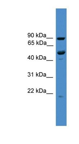 Western Blot: MB21D2 Antibody [NBP1-79527] - Titration: 0.2-1 ug/ml, Positive Control: 293T cell lysate.