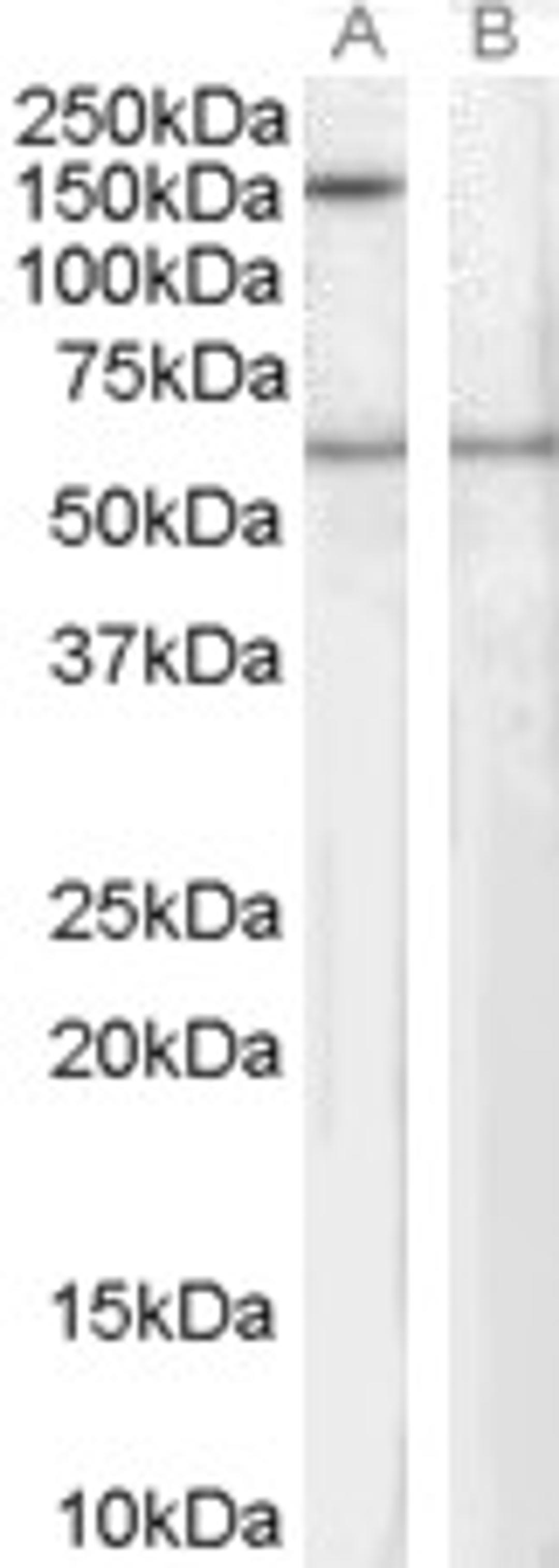 46-371 staining (1ug/ml) of Human EBV-immortilized lymphoblastoid lysate (RIPA buffer, 35ug total protein per lane). Primary incubated for 1 hour. Detected by western blot using chemiluminescence.