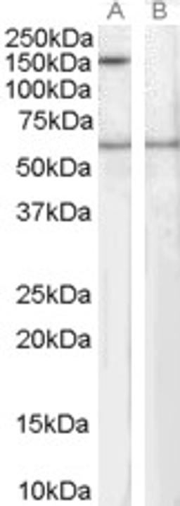 46-371 staining (1ug/ml) of Human EBV-immortilized lymphoblastoid lysate (RIPA buffer, 35ug total protein per lane). Primary incubated for 1 hour. Detected by western blot using chemiluminescence.