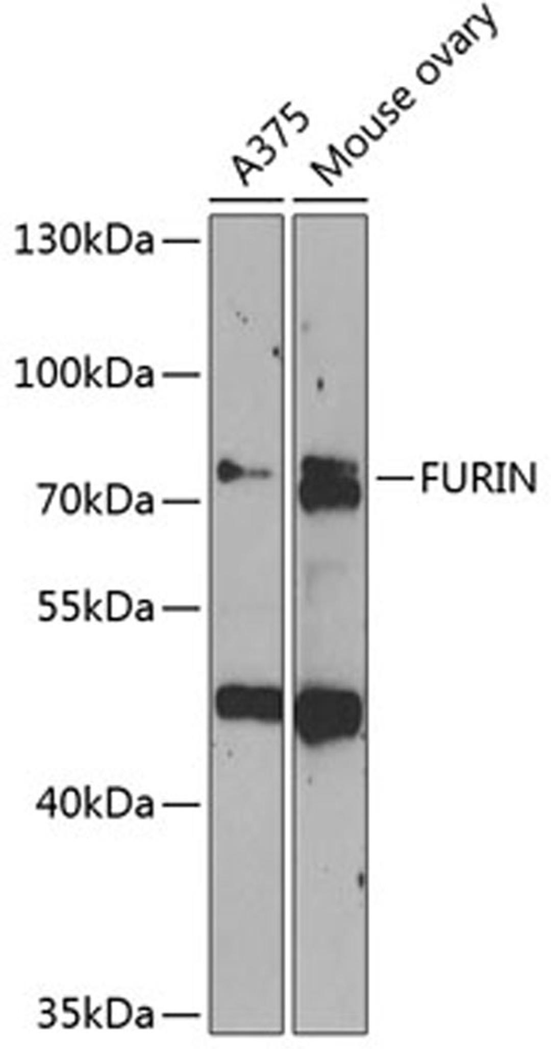 Western blot - FURIN antibody (A13335)