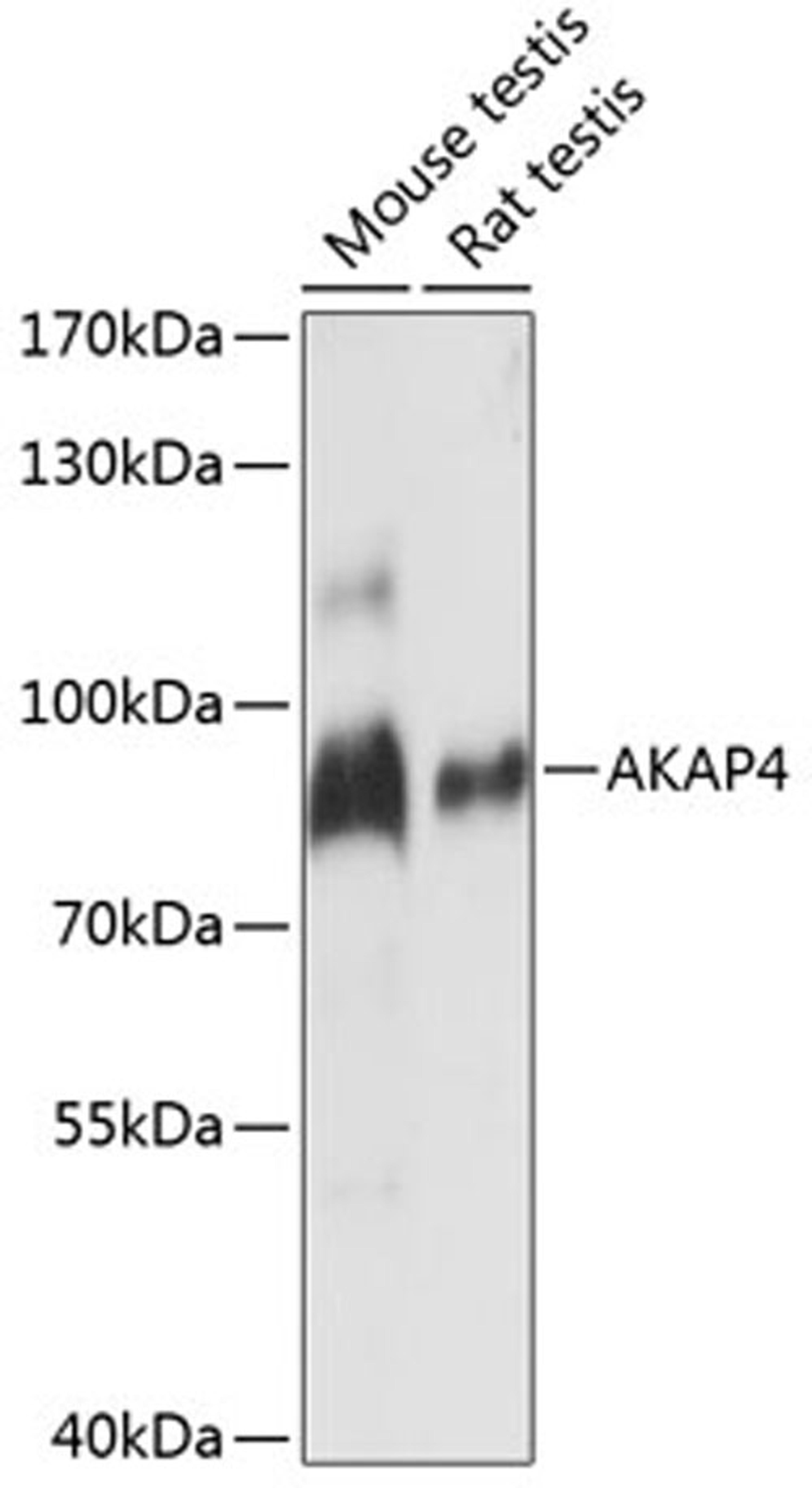 Western blot - AKAP4 antibody (A14813)