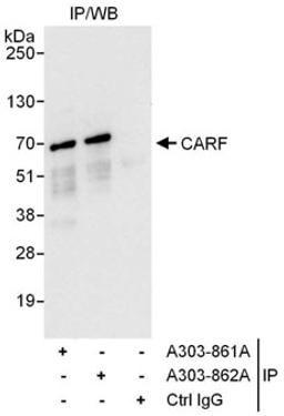 Detection of human CARF by western blot of immunoprecipitates.