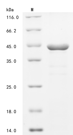 (Tris-Glycine gel) Discontinuous SDS-PAGE (reduced) with 5% enrichment gel and 15% separation gel.