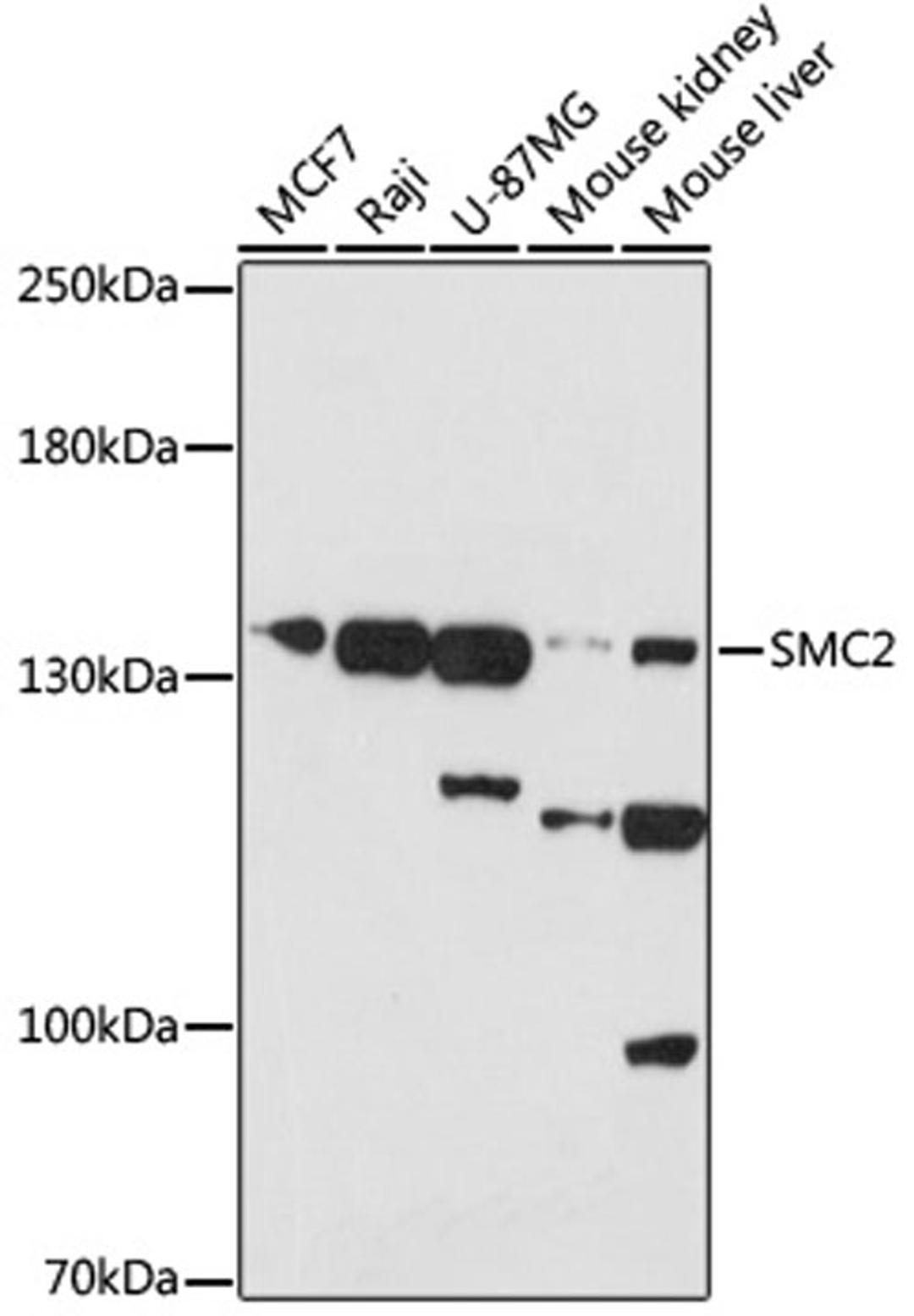 Western blot - SMC2 antibody (A17867)