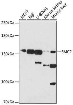 Western blot - SMC2 antibody (A17867)