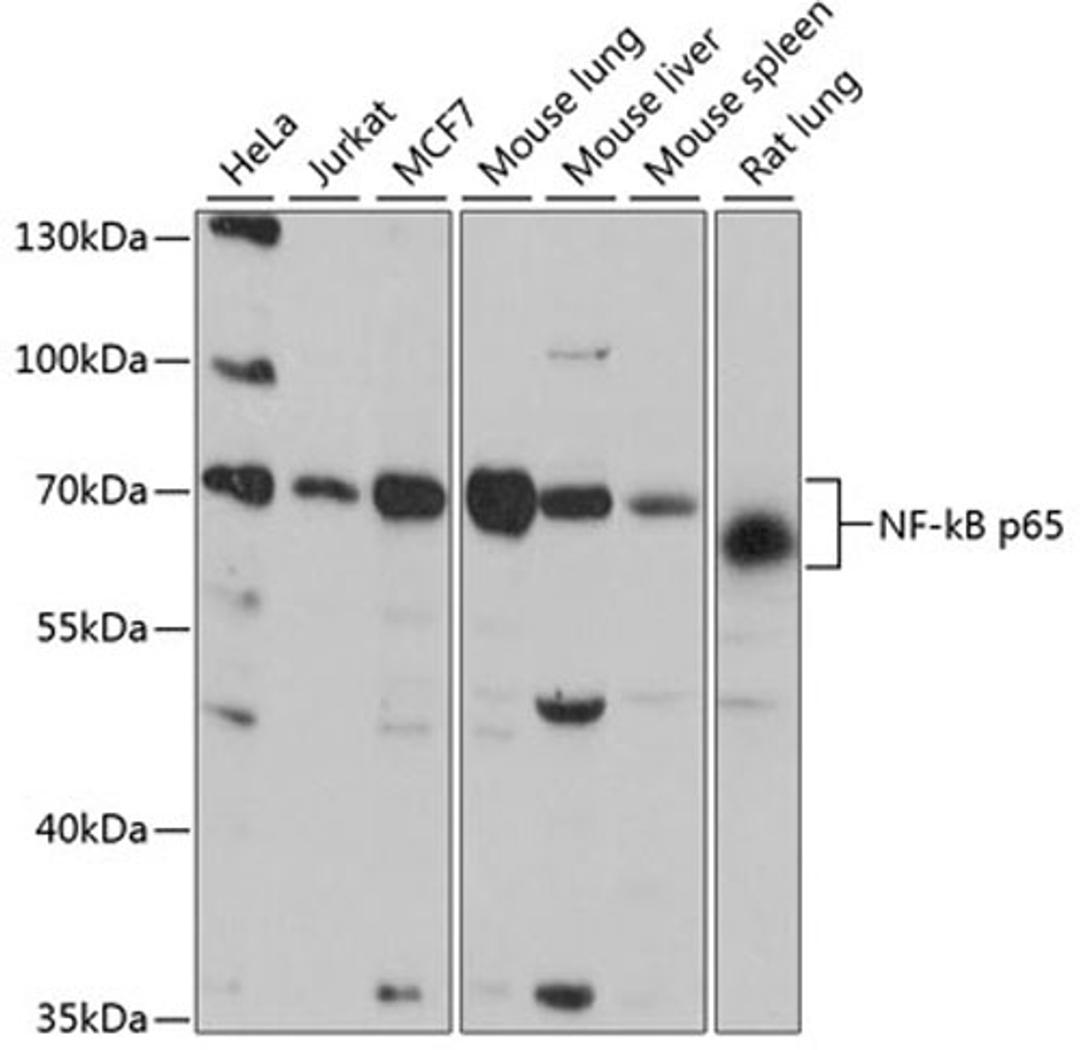 Western blot - NF-kB p65 antibody (A16271)