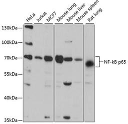 Western blot - NF-kB p65 antibody (A16271)