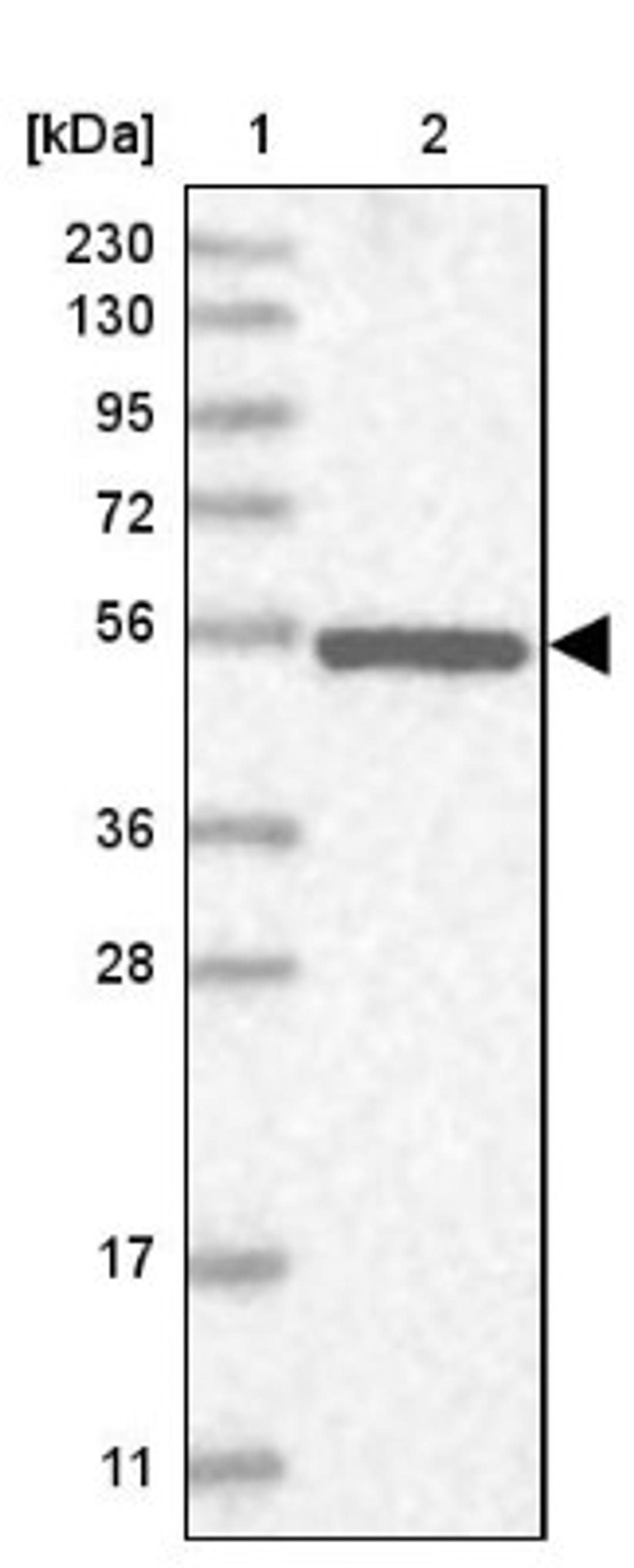 Western Blot: NPEPL1 Antibody [NBP2-13668] - Lane 1: Marker [kDa] 230, 130, 95, 72, 56, 36, 28, 17, 11<br/>Lane 2: Human cell line RT-4