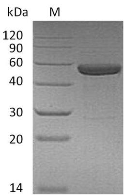 (Tris-Glycine gel) Discontinuous SDS-PAGE (reduced) with 5% enrichment gel and 15% separation gel.