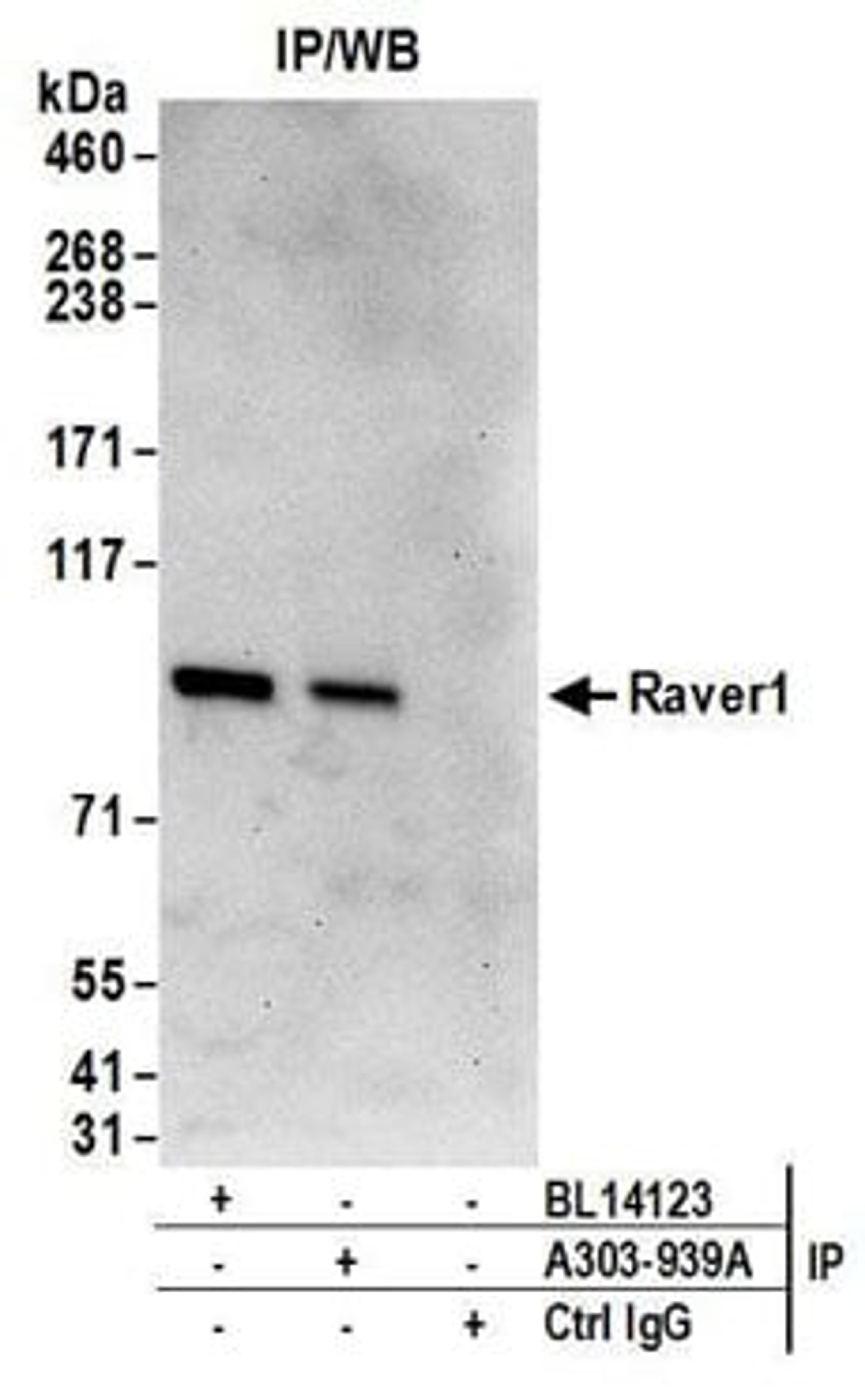 Detection of human Raver1 by western blot of immunoprecipitates.