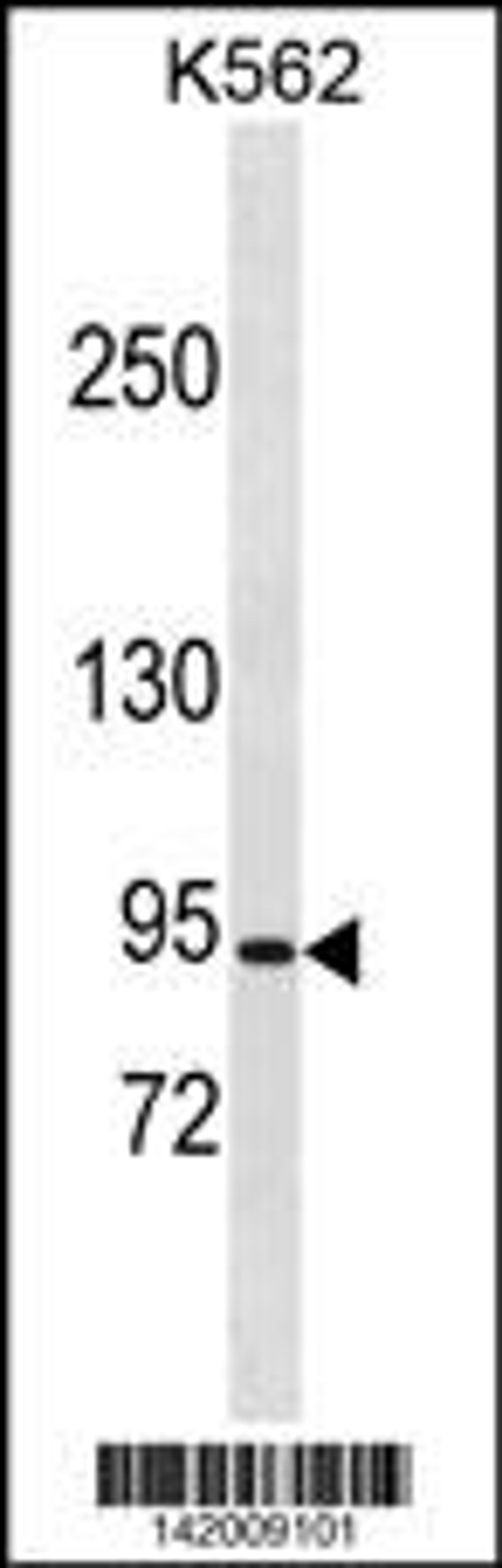 Western blot analysis in K562 cell line lysates (35ug/lane).