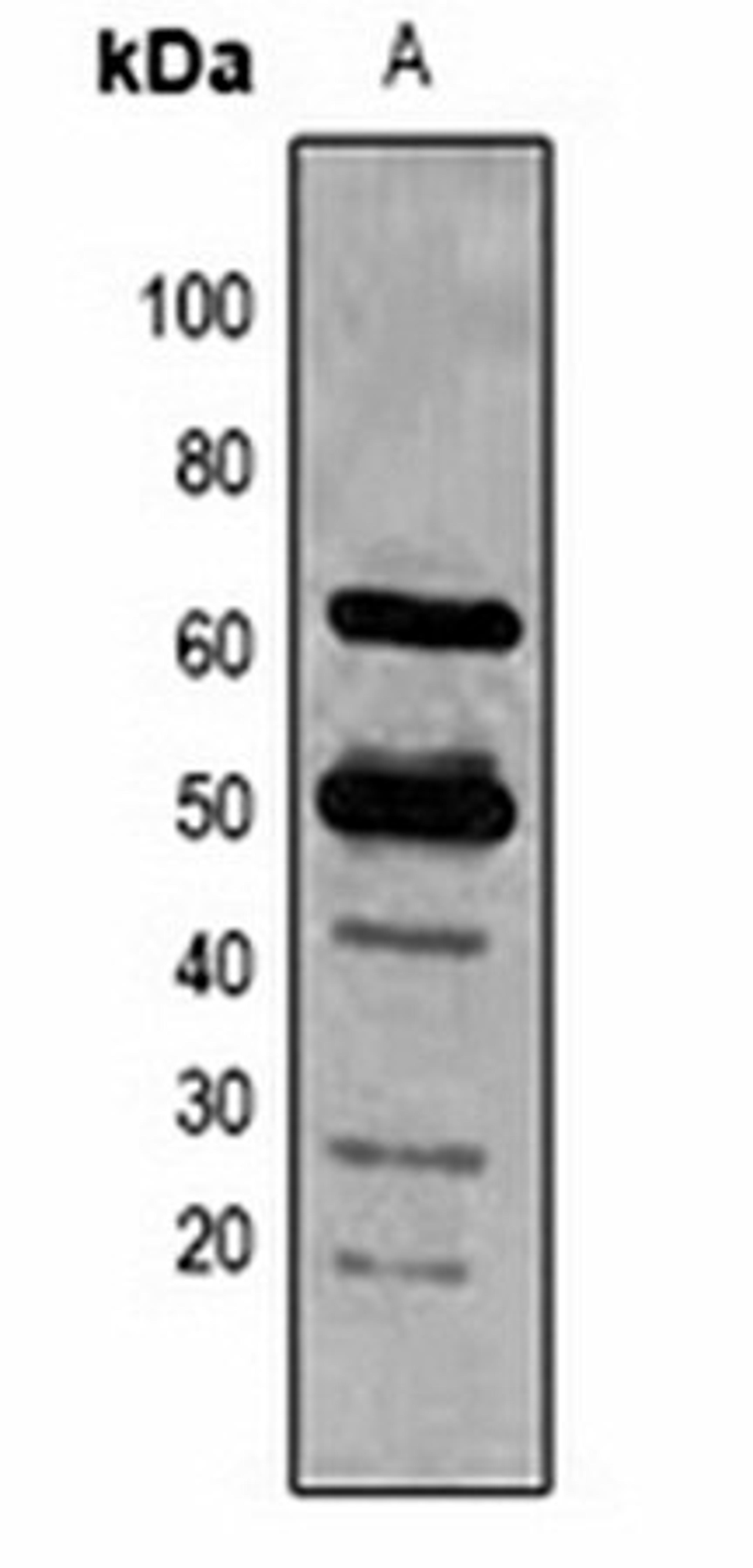 Western blot analysis of Arabidopsis thaliana (Lane 1) whole cell lysates using Rubisco Large Chain antibody