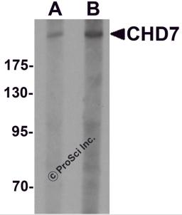 Western blot analysis of CHD7 in SK-N-SH cell lysate with CHD7 antibody at (A) 1 and (B) 2 &#956;g/mL.