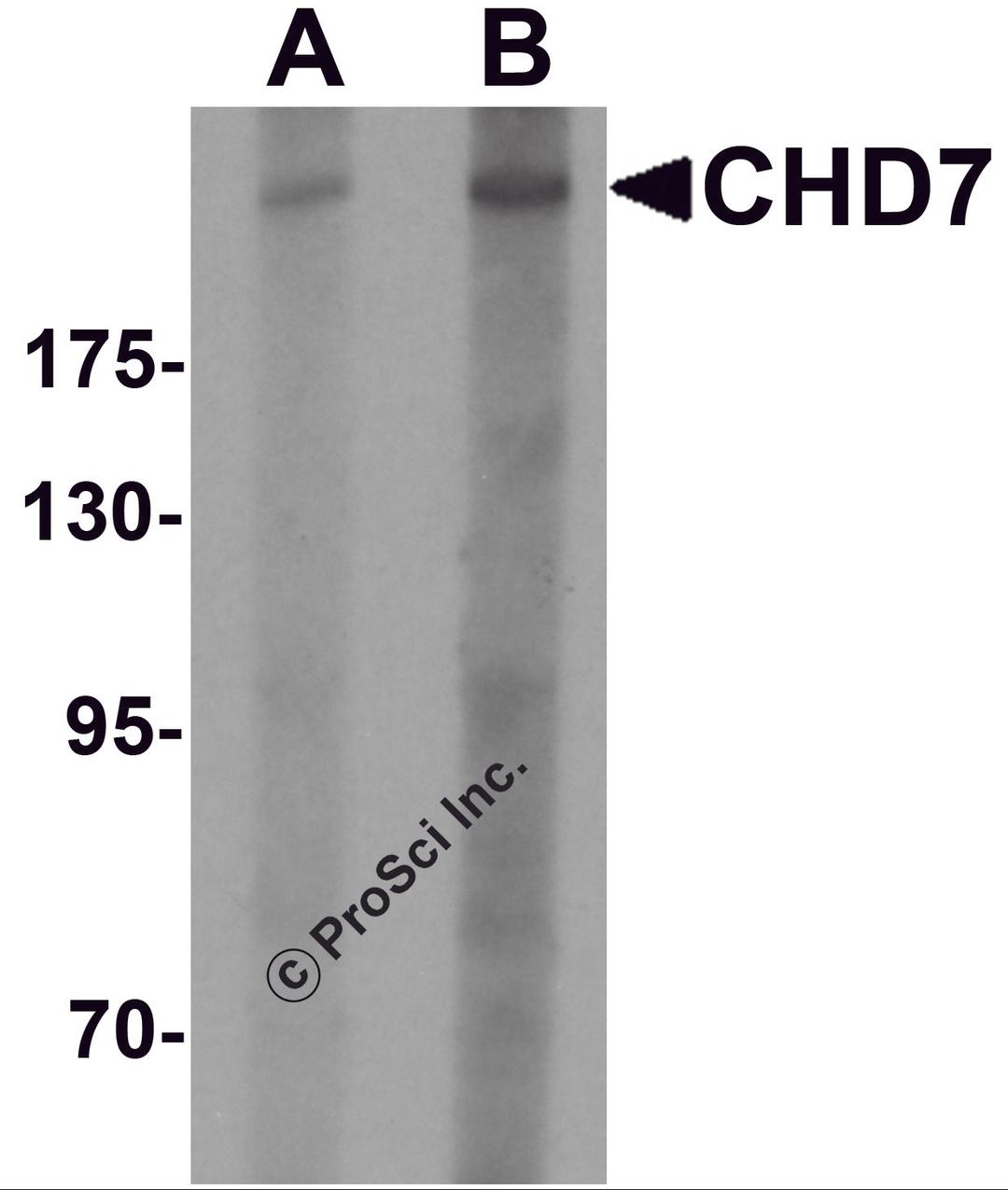 Western blot analysis of CHD7 in SK-N-SH cell lysate with CHD7 antibody at (A) 1 and (B) 2 μg/mL.