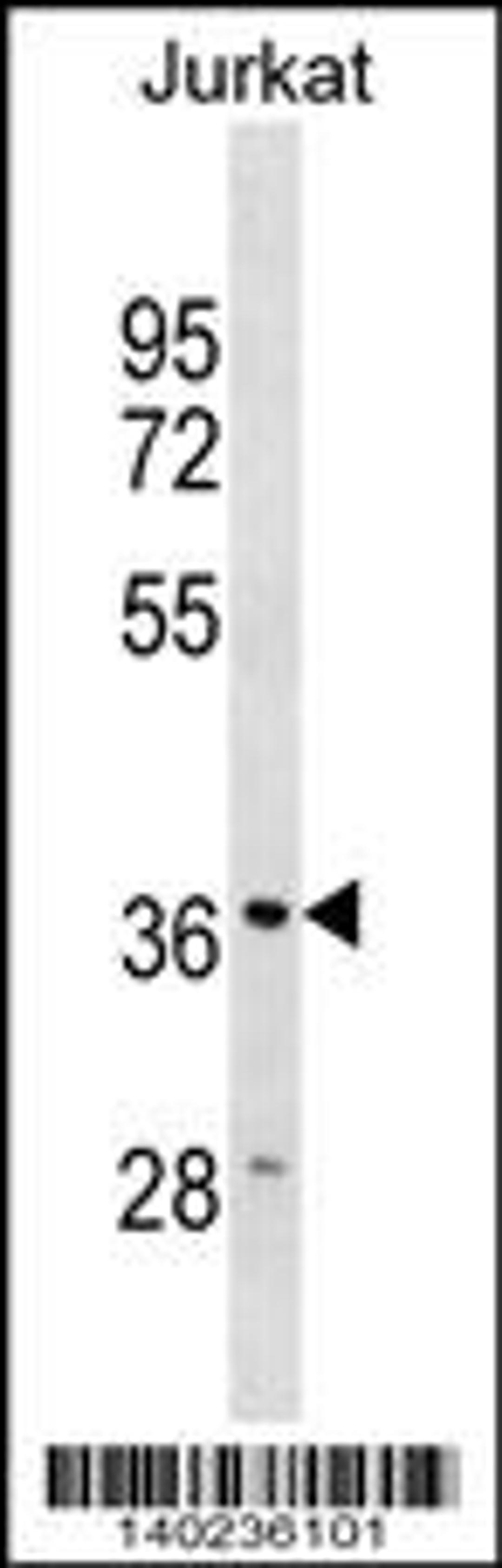 Western blot analysis in Jurkat cell line lysates (35ug/lane).