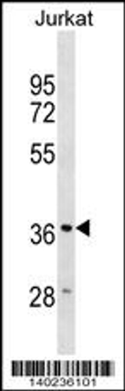 Western blot analysis in Jurkat cell line lysates (35ug/lane).