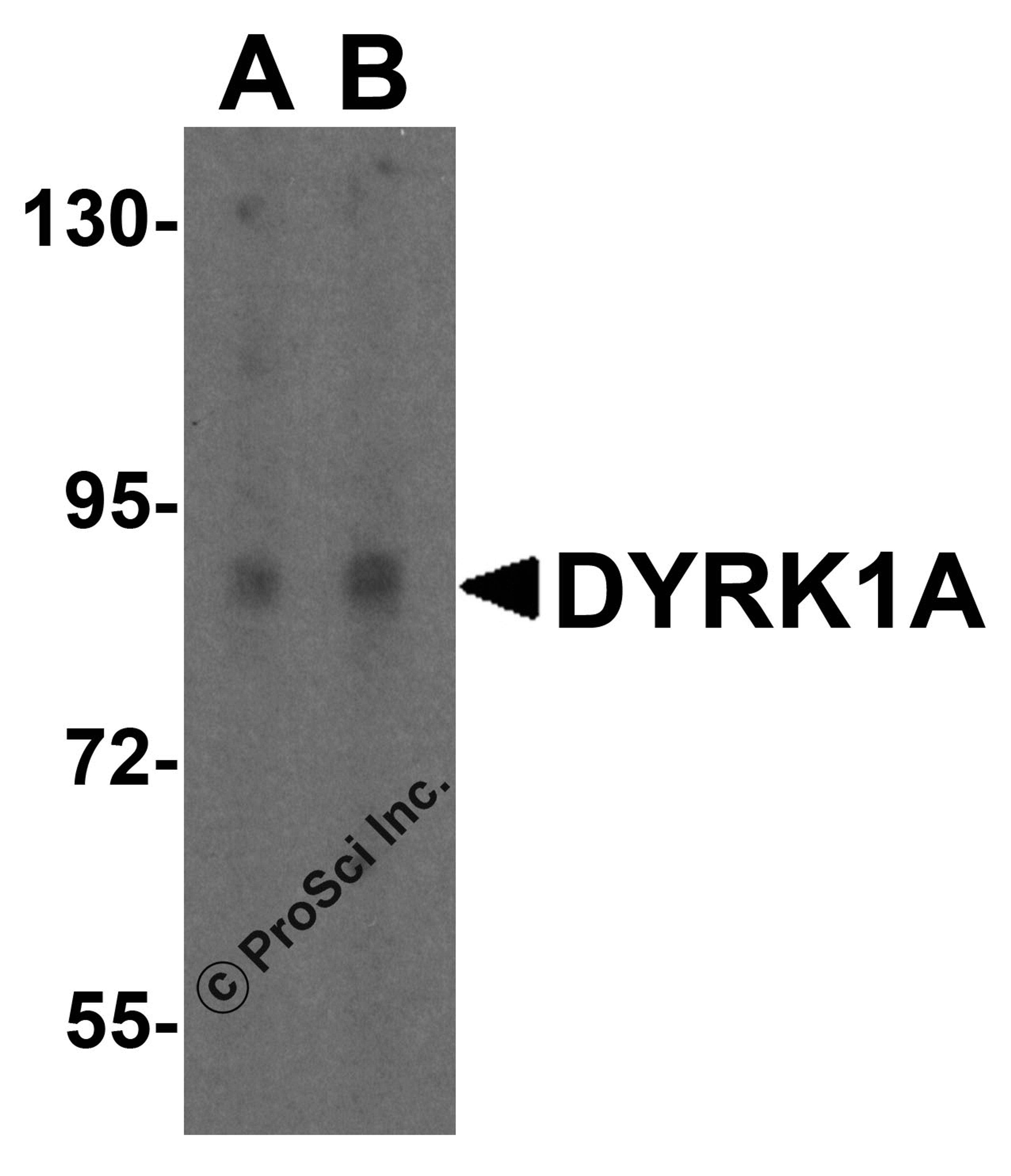 Western blot analysis of DYRK1A in HeLa cell lysate with DYRK1A antibody at (A) 1 and (B) 2 μg/mL.