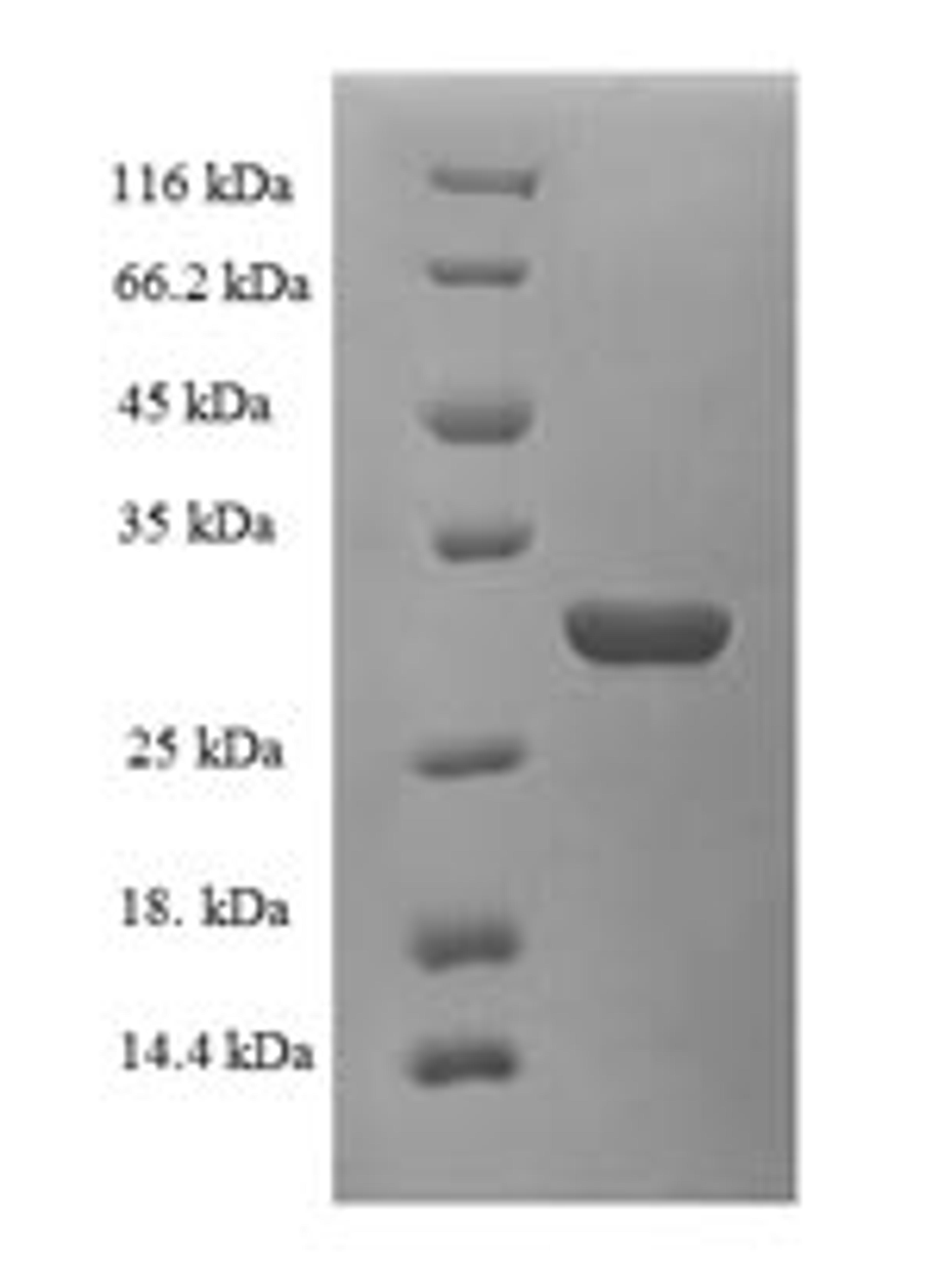 (Tris-Glycine gel) Discontinuous SDS-PAGE (reduced) with 5% enrichment gel and 15% separation gel.