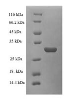 (Tris-Glycine gel) Discontinuous SDS-PAGE (reduced) with 5% enrichment gel and 15% separation gel.