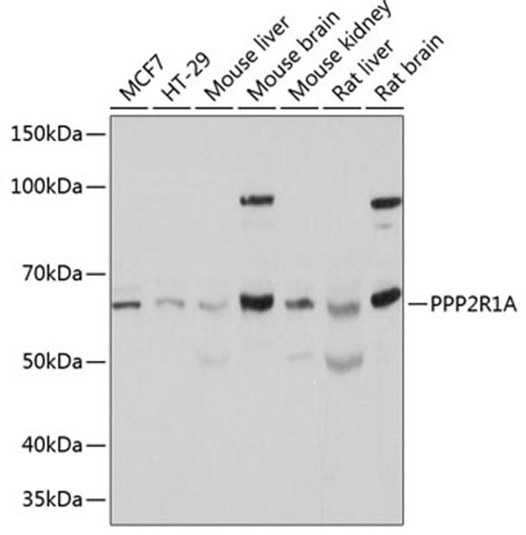 Western blot - PPP2R1A Polyclonal Antibody (A5799)