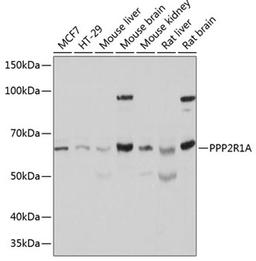 Western blot - PPP2R1A Polyclonal Antibody (A5799)