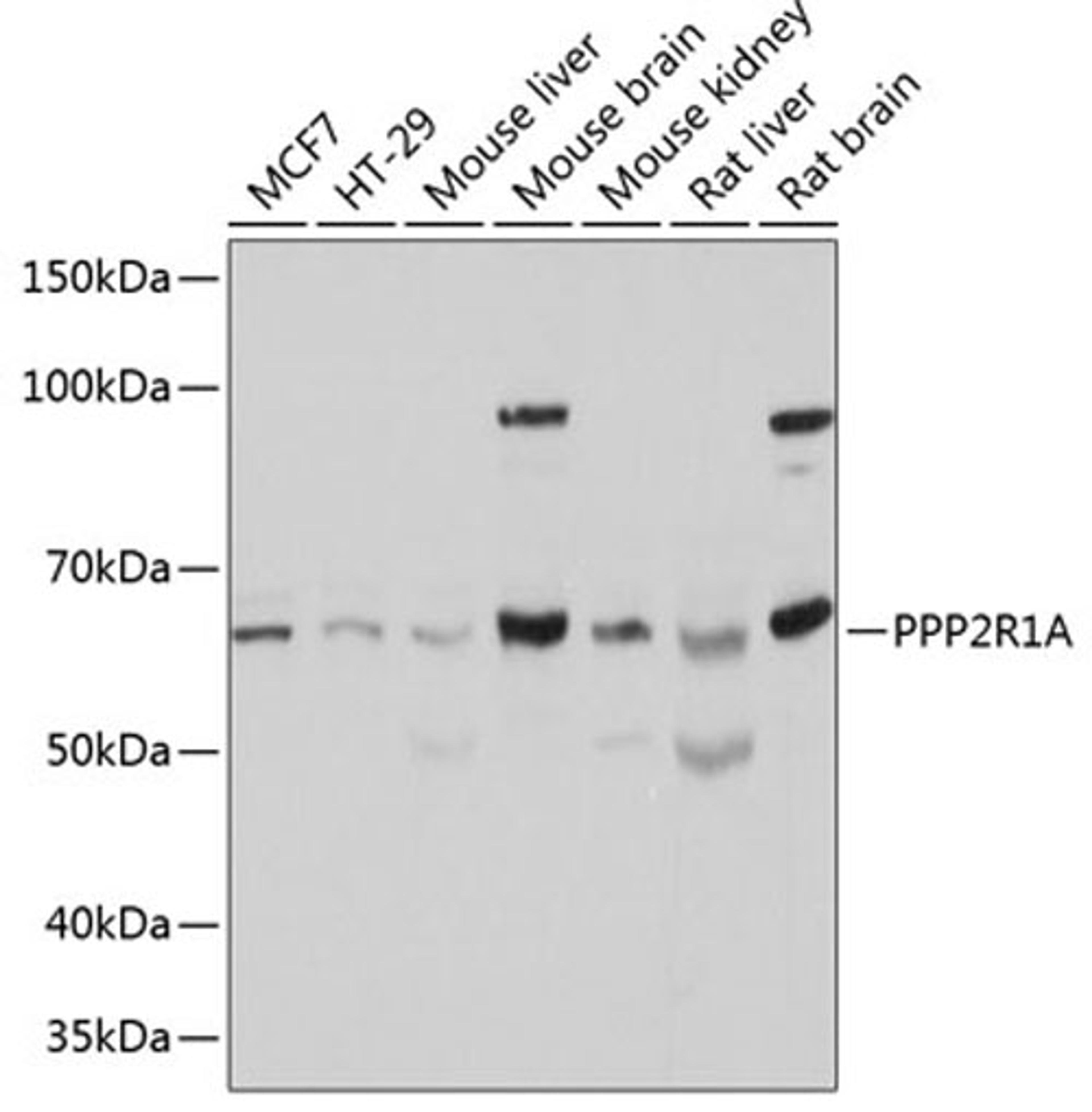 Western blot - PPP2R1A Polyclonal Antibody (A5799)