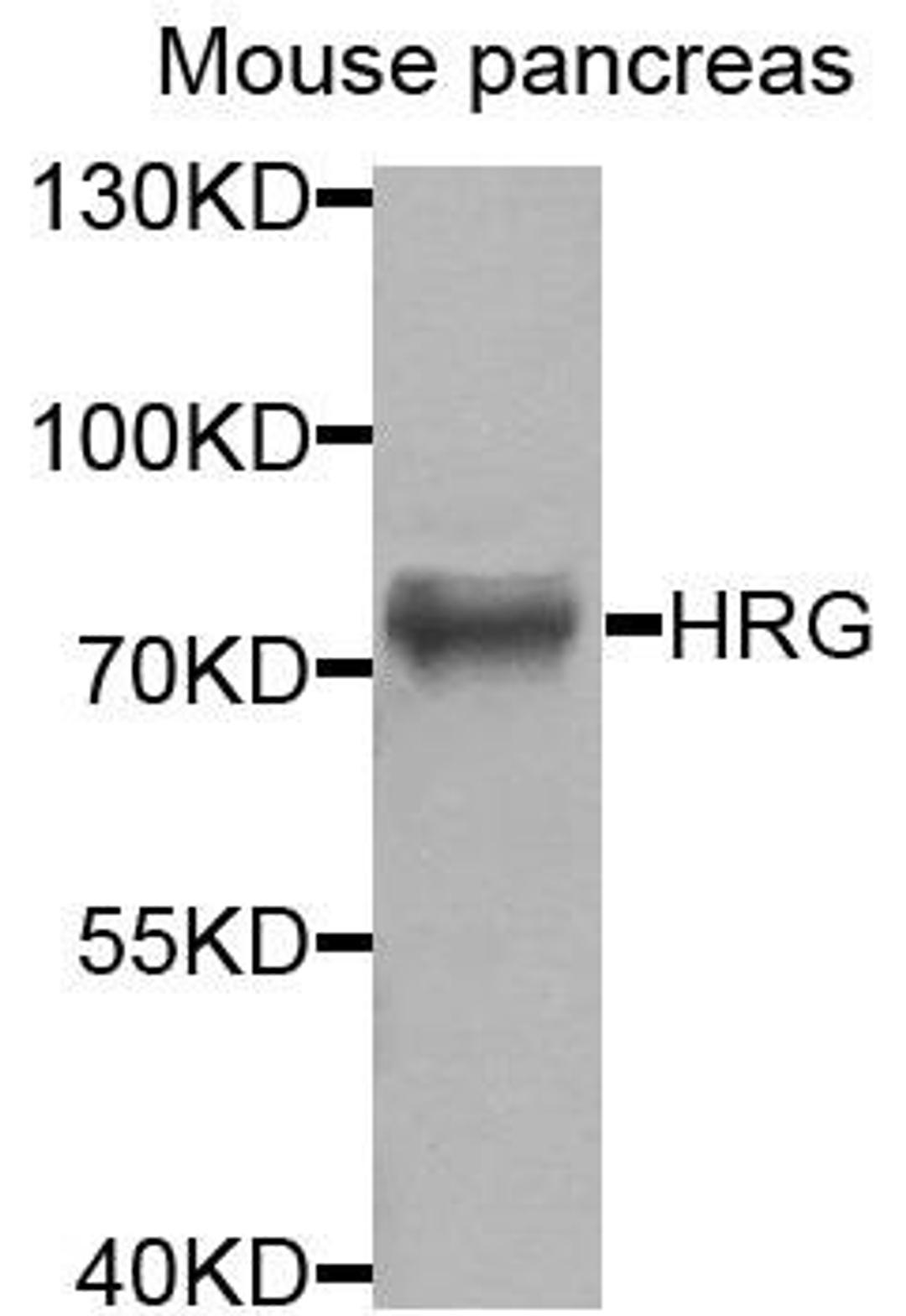 Western blot analysis of extracts of mouse pancreas cells using HRG antibody