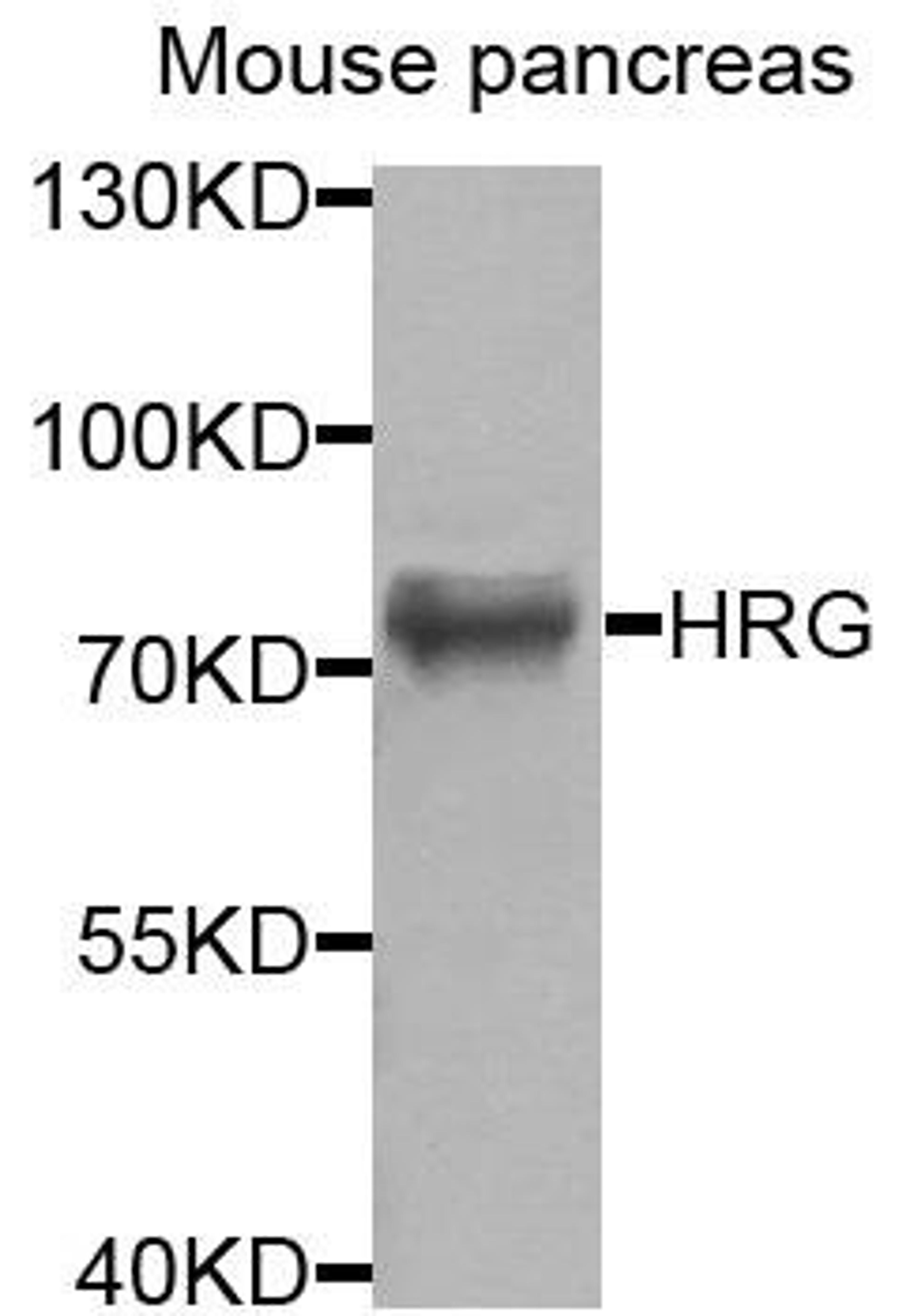 Western blot analysis of extracts of mouse pancreas cells using HRG antibody