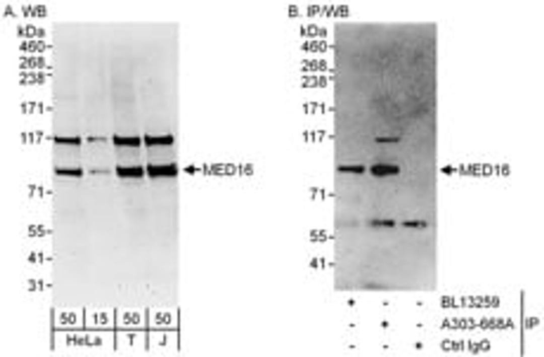 Detection of human MED16 by western blot and immunoprecipitation.